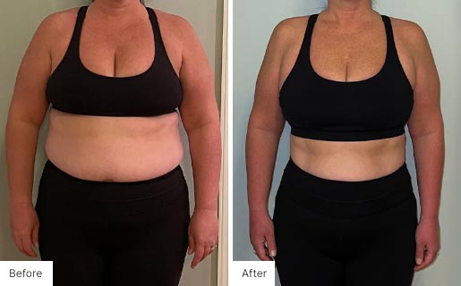 4 - Before and After Real Results image of a woman that has used the NeoraFit™ New Year Reset Program.
